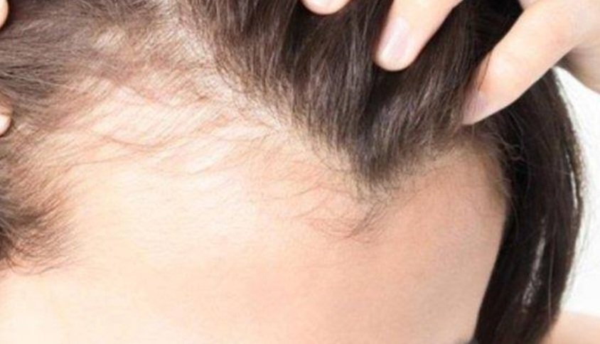 Screenshot 20231112 095804 Google