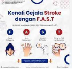 gejala stroke