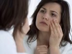 16 Home Remedies To Get Rid Of Eye Bags
