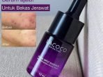 eksfo lacoco