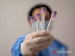 hantavirus1.jpg